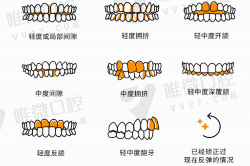 戴假牙和真牙有什么区别,拔了门牙怎么戴临时牙(图1)